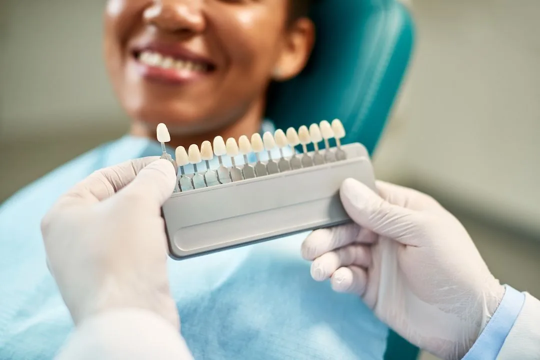 Porcelain Veneers